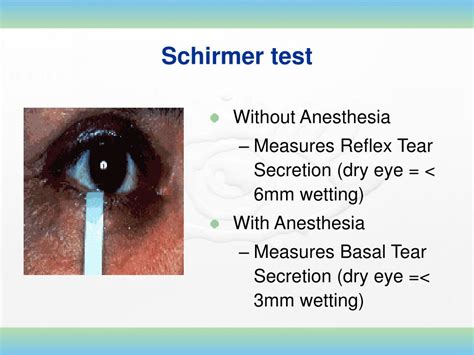 test to evaluate kcs dry eye schirmer tear test|schirmer's test interpretation.